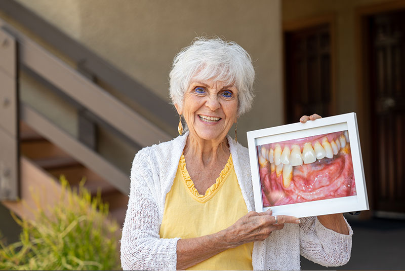 patient showing up a before photo of their teeth before there implant procedure