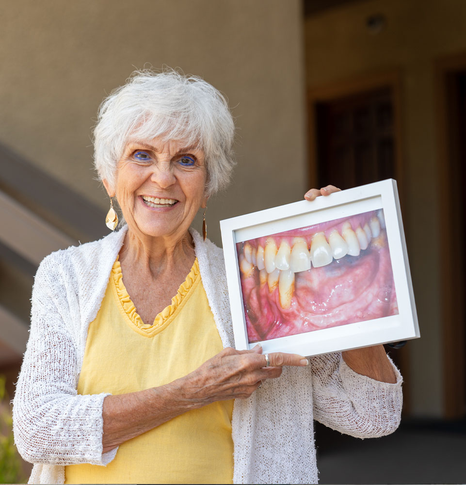 patient showing up a before photo of their teeth before there implant procedure